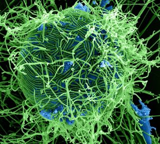 enfermedad que provaca inmunidad al ebola