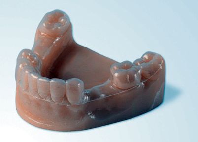 las impresoras en la ortodoncia