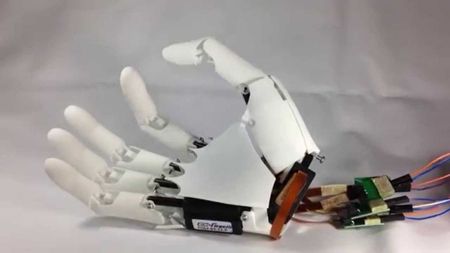 la mano bionica